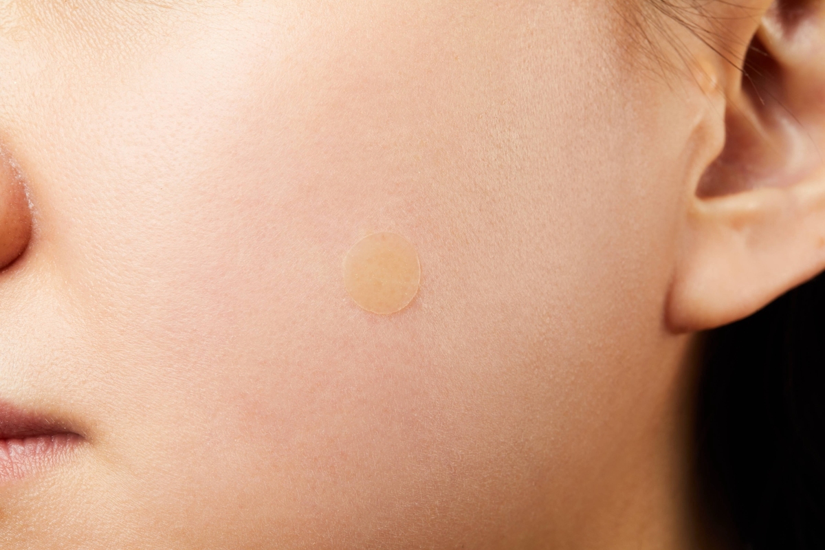 Acne Pimple Master 24 patches 4